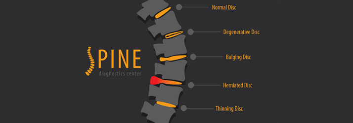 Chiropractic Green Bay WI Disc Injury